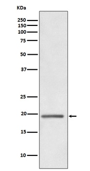 Anti-HE4 WFDC2 Rabbit Monoclonal Antibody