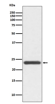 Anti-HE4 WFDC2 Rabbit Monoclonal Antibody