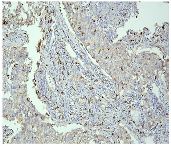 Anti-PPT1 Antibody (monoclonal, 10F3)