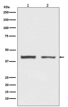hnRNP C1/C2 Rabbit Monoclonal Antibody