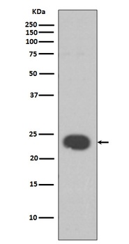 Anti-HP1 alpha CBX5 Rabbit Monoclonal Antibody