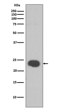 HP1 alpha CBX5 Rabbit Monoclonal Antibody