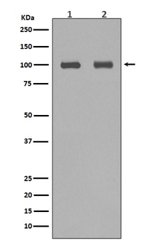 Aconitase 1 ACO1 Rabbit Monoclonal Antibody