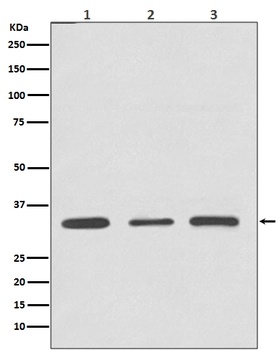 ATF5 Rabbit Monoclonal Antibody