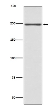 Anti-Myosin heavy chain MYH6 Rabbit Monoclonal Antibody