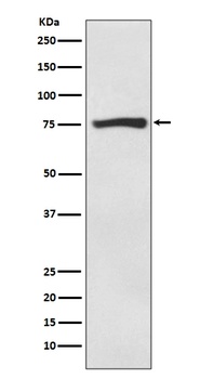 ACSS2/Acetyl Coa Synthetase Rabbit Monoclonal Antibody