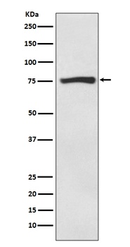 Anti-ACSS2/Acetyl Coa Synthetase Rabbit Monoclonal Antibody
