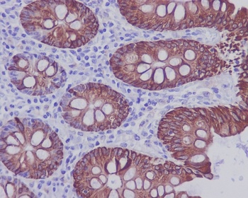 Anti-Cytokeratin 20 KRT20 Rabbit Monoclonal Antibody