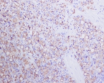 Anti-PSMA FOLH1 Rabbit Monoclonal Antibody