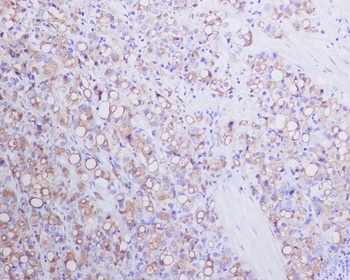 PSMA FOLH1 Rabbit Monoclonal Antibody