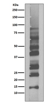 K63-linkage Specific Ubiquitin UBB Rabbit Monoclonal Antibody
