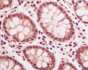 Anti-Ubiquitin UBB Rabbit Monoclonal Antibody