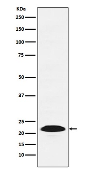 PSB9 / LMP2 Rabbit Monoclonal Antibody