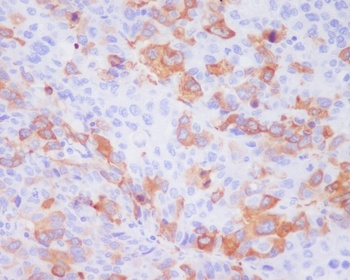 Anti-TACC3 Rabbit Monoclonal Antibody