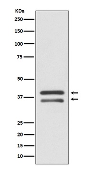 MEK3 MAP2K3 Rabbit Monoclonal Antibody