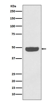 Anti-NSE ENO2 Rabbit Monoclonal Antibody