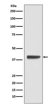 Anti-Islet 1 Rabbit Monoclonal Antibody