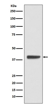 Islet 1 Rabbit Monoclonal Antibody