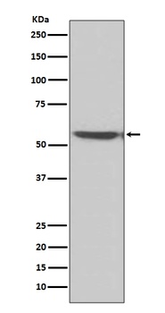 Anti-Calcineurin A Rabbit Monoclonal Antibody