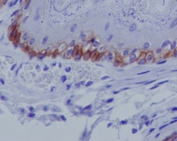 Collagen XVII Rabbit Monoclonal Antibody