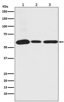 Anti-USP14 Rabbit Monoclonal Antibody
