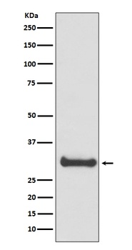 Anti-Calbindin CALB1 Rabbit Monoclonal Antibody