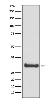 Calbindin CALB1 Rabbit Monoclonal Antibody