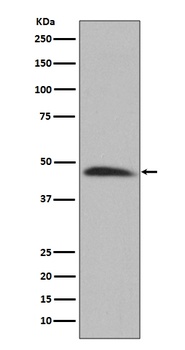 Hsp47 SERPINH1 Rabbit Monoclonal Antibody