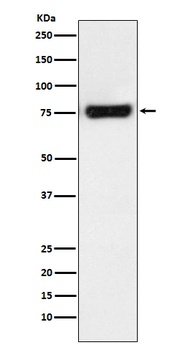 Anti-MTA2 Monoclonal Antibody