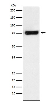 MTA2 Monoclonal Antibody