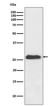 Anti-NQO2 Rabbit Monoclonal Antibody