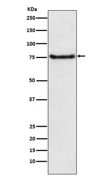 Anti-BDKRB2 Monoclonal Antibody
