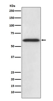 Catalase Rabbit Monoclonal Antibody