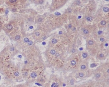 Anti-Glutamine Synthetase GLUL Rabbit Monoclonal Antibody