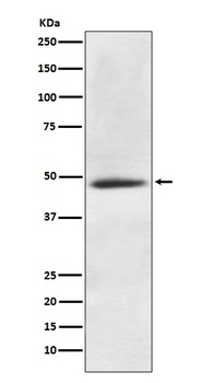 CaMKII alpha CAMK2A Rabbit Monoclonal Antibody