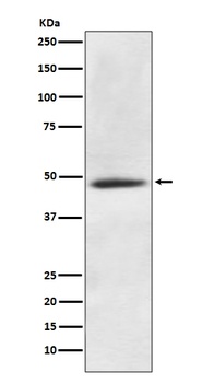 Anti-CaMKII alpha CAMK2A Rabbit Monoclonal Antibody