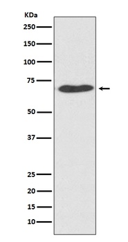 PDI PDIA2 Rabbit Monoclonal Antibody
