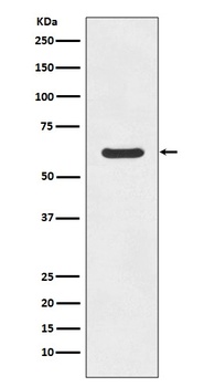 ASNS/Asparagine Synthetase Rabbit Monoclonal Antibody