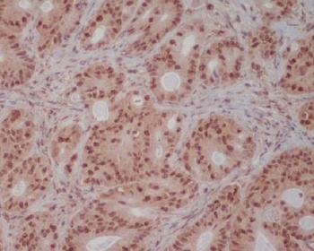 Anti-PI 3 Kinase p85 beta PIK3R2 Rabbit Monoclonal Antibody
