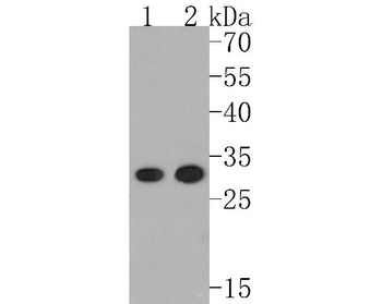 DARPP32 PPP1R1B Rabbit Monoclonal Antibody
