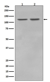 Anti-RNF20 Rabbit Monoclonal Antibody