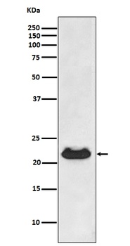 Anti-CRYAB/Alpha B Crystallin Rabbit Monoclonal Antibody