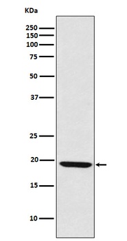 Anti-LMO2 Monoclonal Antibody