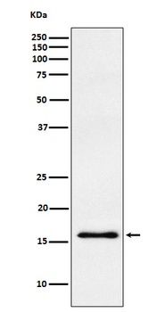 Anti-gamma Synuclein Rabbit Monoclonal Antibody