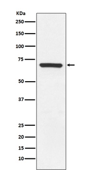 Anti-MEKK3 MAP3K3 Rabbit Monoclonal Antibody