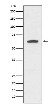Anti-Cytokeratin 9 KRT9 Rabbit Monoclonal Antibody