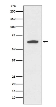 Cytokeratin 9 KRT9 Rabbit Monoclonal Antibody