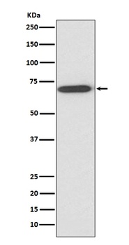 Perilipin A PLIN1 Rabbit Monoclonal Antibody