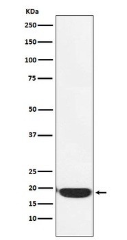 Anti-PERP Monoclonal Antibody