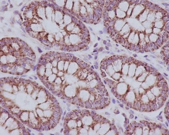 Anti-TOMM20/Tom20 Rabbit Monoclonal Antibody